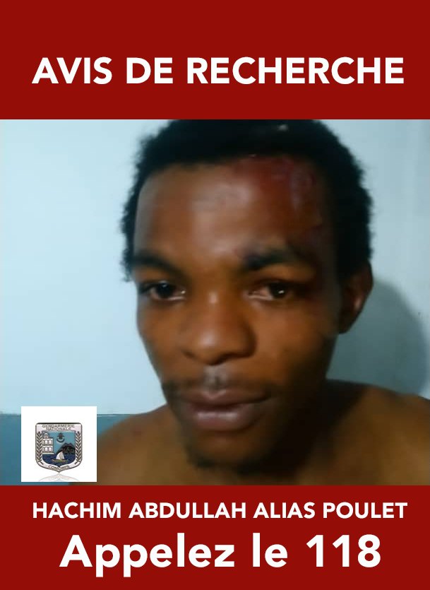 image Agression dans le Mboude : Poulet activement recherché par la gendarmerie